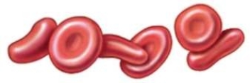<strong>What is the function of the cells in this picture? </strong> A) Disease immunity B) Oxygen transport C) Immune defense D) Blood clotting