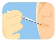 <strong>Complete la oración según la imagen.El enfermero le _____ a Leonardo en la clínica. </strong> A) le pone una inyección B) le toma la temperatura C) le da pastillas D) receta una medicina