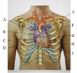 Where would the nurse place a stethoscope to assess the Point of Maximal Impulse (PMI)?