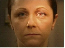 A nurse makes this finding when assessing a patient. What does the nurse understand about this assessment?