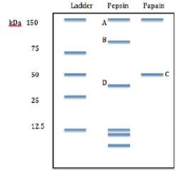 <strong>On the gel below, which bands would you expect to bind antigen? </strong> A)B and A B)B and B C)B and C D)B and D E)B and A, B, and C