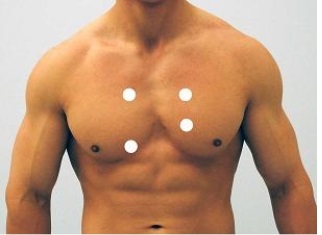 <strong>Which figure below correctly shows the four sites used for auscultation of heart sounds?</strong> A) B) C) D) E)