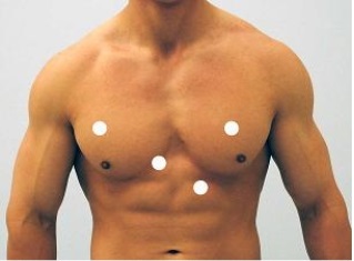 <strong>Which figure below correctly shows the four sites used for auscultation of heart sounds?</strong> A) B) C) D) E)