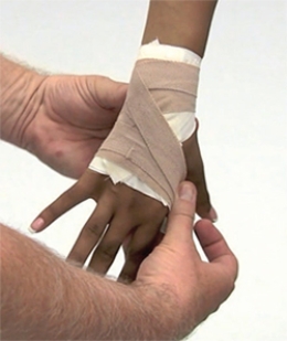 <strong>The diagram represents a taping technique for the wrist, hand, and fingers that could be used for which of the following problems? </strong> A) Tenosynovitis B) Wrist sprain C) Nerve compression D) Nerve entrapment E) Carpal tunnel