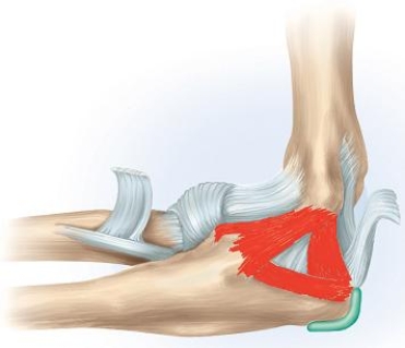 <strong>In which of the following movements is the highlighted structure in the given figure of major importance? </strong> A) Forceful extension-pronation movement B) Forceful extension-supination movement C) Forceful extension movement D) Forceful flexion-supination movement E) Forceful flexion-pronation movement