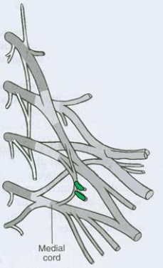 <strong>What is the CORRECT title of the highlighted peripheral nerve? </strong> A) Pectoral nerve (medial and lateral) B) Dorsal scapular nerve (posterior) C) Axillary nerve D) Musculocutaneous nerve E) Suprascapular nerve