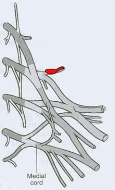 <strong>What is the CORRECT title of the highlighted peripheral nerve? </strong> A) Pectoral nerve B) Dorsal scapular nerve C) Axillary nerve D) Musculocutaneous nerve E) Suprascapular nerve