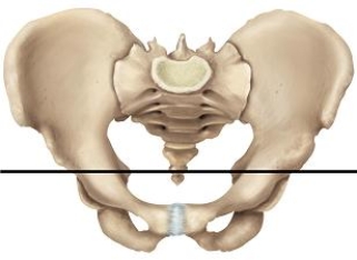 <strong>Please draw a line in the correct location that separates the false and true pelvic areas.</strong> A) B) C) D) E)