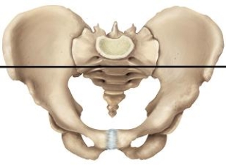 <strong>Please draw a line in the correct location that separates the false and true pelvic areas.</strong> A) B) C) D) E)