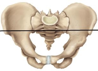 <strong>Please draw a line in the correct location that separates the false and true pelvic areas.</strong> A) B) C) D) E)