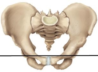 <strong>Please draw a line in the correct location that separates the false and true pelvic areas.</strong> A) B) C) D) E)