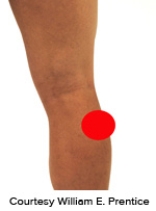 <strong>Please identify the correct location of a baker's cyst.</strong> A) B) C) D) E)
