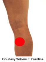 <strong>Please identify the correct location of a baker's cyst.</strong> A) B) C) D) E)