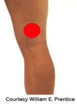 <strong>Please identify the correct location of a baker's cyst.</strong> A) B) C) D) E)