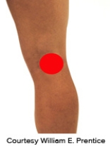 <strong>Please identify the correct location of a baker's cyst.</strong> A) B) C) D) E)