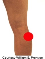 <strong>Please identify the correct location of a baker's cyst.</strong> A) B) C) D) E)