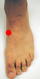 <strong>Please identify the area of the foot where a Jones fracture would most likely occur.</strong> A) B) C) D) E)