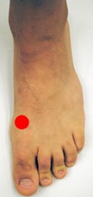 <strong>Please identify the area of the foot where a Jones fracture would most likely occur.</strong> A) B) C) D) E)