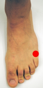 <strong>Please identify the area of the foot where a Jones fracture would most likely occur.</strong> A) B) C) D) E)