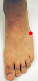<strong>Please identify the area of the foot where a Jones fracture would most likely occur.</strong> A) B) C) D) E)