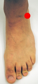 <strong>Please identify the area of the foot where a Jones fracture would most likely occur.</strong> A) B) C) D) E)