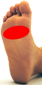 <strong>Please identify the area where callus develops on a person who is suffering from metatarsalgia.</strong> A) B) C) D) E)