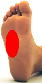 <strong>Please identify the area where callus develops on a person who is suffering from metatarsalgia.</strong> A) B) C) D) E)