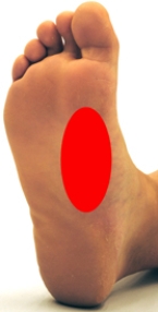 <strong>Please identify the area where callus develops on a person who is suffering from metatarsalgia.</strong> A) B) C) D) E)