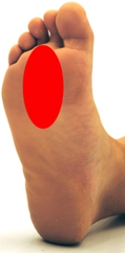 <strong>Please identify the area where callus develops on a person who is suffering from metatarsalgia.</strong> A) B) C) D) E)