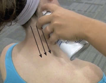 <strong>Which of the following statements is correct regarding this modality? </strong> A) The spray should be held at a 90 degree angle B) The spray should only be 2-3 inches from the injured muscle C) The spray should be perpendicular D) The patient should do active stretching while the spray is being applied E) The spray should cover the skin area 1-2 times