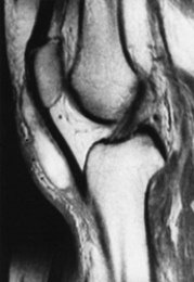 <strong>Which of the following imaging techniques illustrated in the pictures would be the most efficient to discover if there is a nerve root compression at the L<sub>4</sub> level?</strong> A) B) C) D) E)