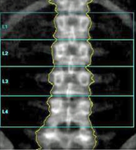 <strong>Which of the following imaging techniques illustrated in the pictures would be the most efficient to discover if there is a nerve root compression at the L<sub>4</sub> level?</strong> A) B) C) D) E)