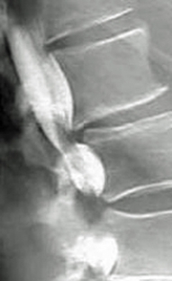 <strong>Which of the following imaging techniques illustrated in the pictures would be the most efficient to discover if there is a nerve root compression at the L<sub>4</sub> level?</strong> A) B) C) D) E)