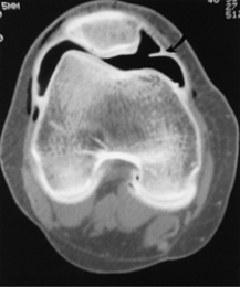 <strong>Which of the following imaging techniques illustrated in the pictures would be the most efficient to discover if there is a nerve root compression at the L<sub>4</sub> level?</strong> A) B) C) D) E)