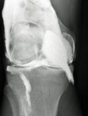 <strong>Which of the following imaging techniques illustrated in the pictures would be the most efficient to discover if there is a loose body within a joint?</strong> A) B) C) D) E)