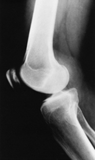 <strong>Which of the following imaging techniques illustrated in the pictures would be the most efficient to discover if there is a loose body within a joint?</strong> A) B) C) D) E)