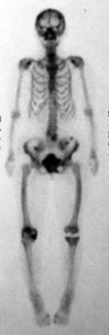 <strong>Which of the following imaging techniques illustrated in the pictures would be the most efficient to discover if there is a loose body within a joint?</strong> A) B) C) D) E)