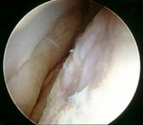 <strong>Which of the following imaging techniques illustrated in the pictures would be the most efficient to discover if there is a loose body within a joint?</strong> A) B) C) D) E)
