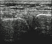 <strong>Which of the following imaging techniques illustrated in the pictures would be the most efficient to evaluate soft-tissue musculoskeletal disorders?</strong> A) B) C) D) E)