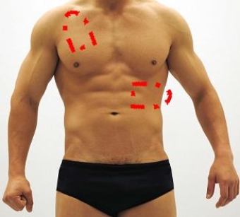 <strong>Please identify each of the correct locations on the victim's chest to place Automated External Defibrillator (AED) pads.</strong> A) B) C) D) E)