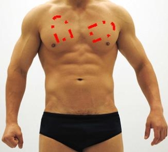 <strong>Please identify each of the correct locations on the victim's chest to place Automated External Defibrillator (AED) pads.</strong> A) B) C) D) E)