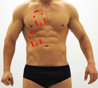<strong>Please identify each of the correct locations on the victim's chest to place Automated External Defibrillator (AED) pads.</strong> A) B) C) D) E)