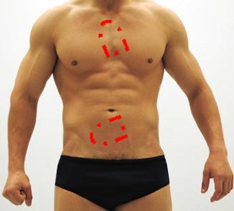 <strong>Please identify each of the correct locations on the victim's chest to place Automated External Defibrillator (AED) pads.</strong> A) B) C) D) E)