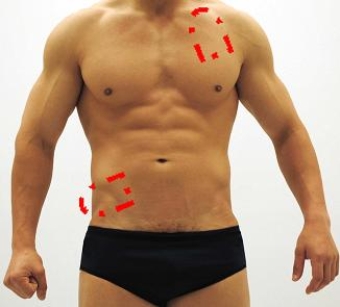 <strong>Please identify each of the correct locations on the victim's chest to place Automated External Defibrillator (AED) pads.</strong> A) B) C) D) E)