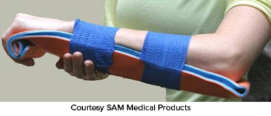 <strong>A patient is suffering from a fracture and dislocation of the ankle. Which of the following emergency splinting techniques would be the most appropriate?</strong> A) B) C) D) E)