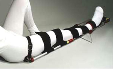 <strong>A patient is suffering from a fracture and dislocation of the ankle. Which of the following emergency splinting techniques would be the most appropriate?</strong> A) B) C) D) E)