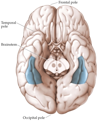 <strong>Refer to the figure. A person who sustained damage to the shaded regions in the figure would be most likely experience which of the following events?</strong> A) When the person's partner comes and talks with them at the hospital, they do not recognize their partner. B) When the person reaches to turn on a light in a dark room, they feel the switch, but they keep searching because they don't recognize it as the light switch. C) A botanist recognizes their partner and children through the window of their hospital room, but can no longer differentiate between the different flowers in the bouquets in the room. D) When looking through a family photo album with their adult daughter, the person asks who the people in the photos are.