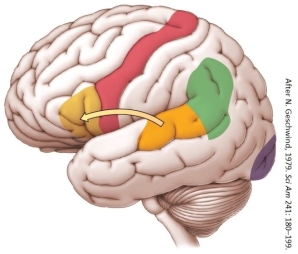 <strong>Refer to the figure. Which statement about the arrow in the figure is most accurate?</strong> A) The arcuate fasciculus is a bundle of axons between Wernicke's area and the precentral gyrus. B) Electrical impulses from Wernicke's area jump over regions of cortex to Broca's area. C) Wernicke's area has been shown to transmit information to Broca's area via the arcuate fasciculus. D) When speaking a word, information is transmitted from Broca's area to Wernicke's area via the arcuate fasciculus.