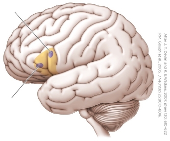 <strong>Refer to the figure. The leaders point to two regions of Broca's area, discovered by _______ to affect _______.</strong> A) Wilder Penfield; speech production and speech processing B) PET; only phonological processing C) DTI; only semantic processing D) TMS; phonological and semantic processing
