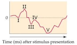 <strong>Refer to the figure. Which choice correctly labels the EEG in the figure?</strong> A) I - P1; II - N1; III - P2; IV - N2; V - P3 B) I - N1; II -N2; III -P1; IV -P2; V - P3 C) I - P1; II - P2; III - N1; IV -N2 ; V - P3 D) I - P1; II - N1; III - P2; IV - N2; V - N2pc